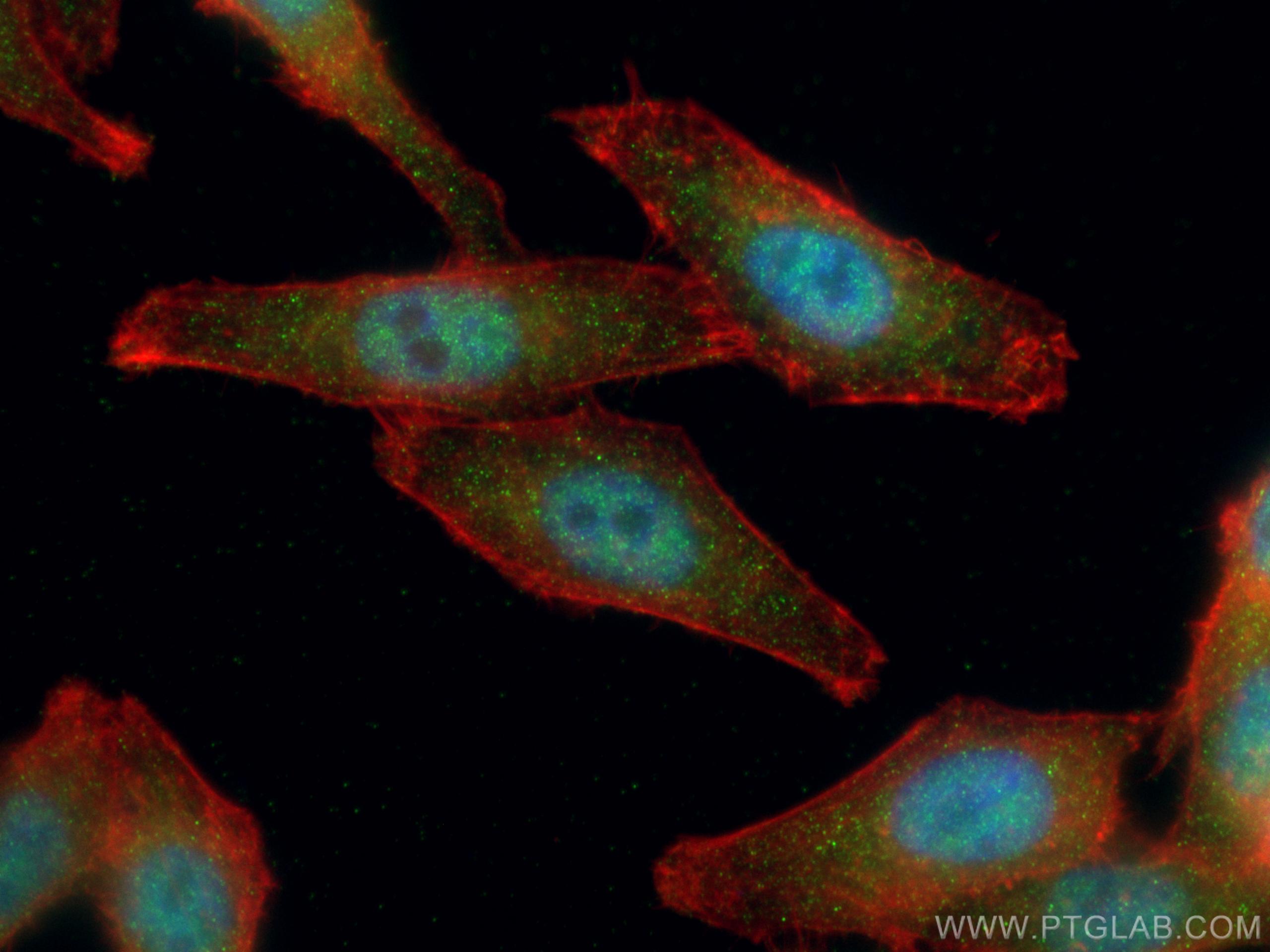 Immunofluorescence (IF) / fluorescent staining of HepG2 cells using GLI2-Specific Polyclonal antibody (18989-1-AP)
