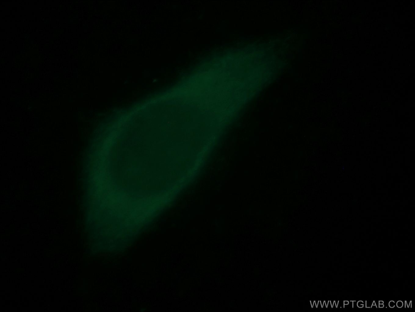 Immunofluorescence (IF) / fluorescent staining of MCF-7 cells using GLI2-Specific Polyclonal antibody (18989-1-AP)