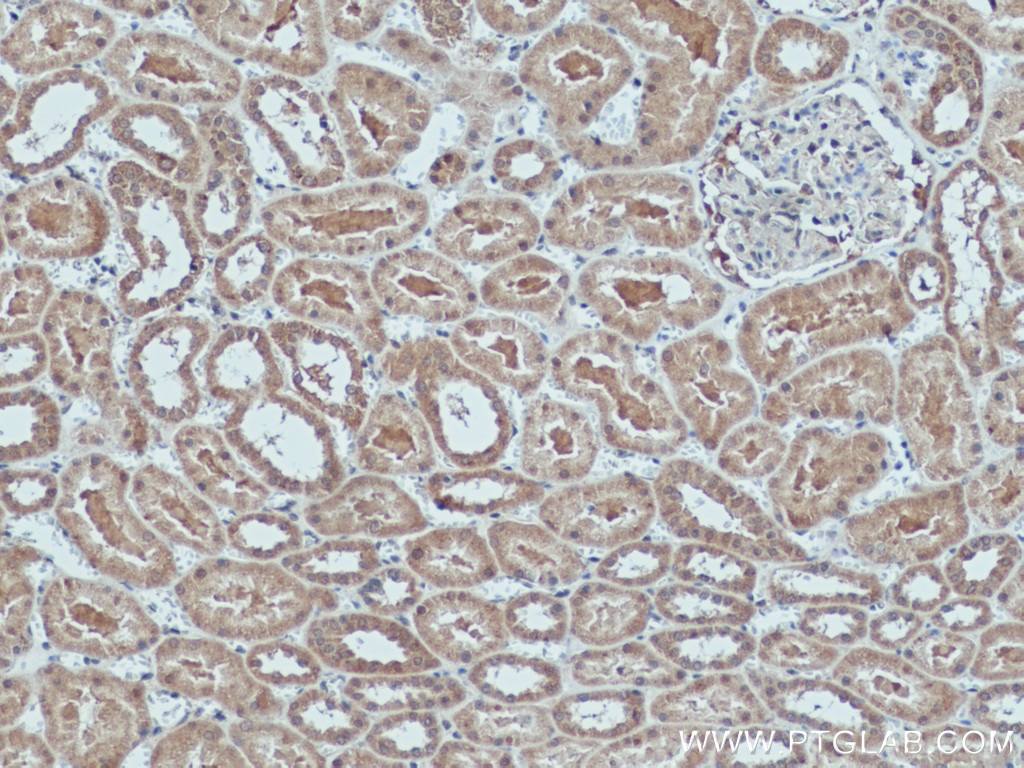Immunohistochemistry (IHC) staining of human kidney tissue using GLI2-Specific Polyclonal antibody (18989-1-AP)