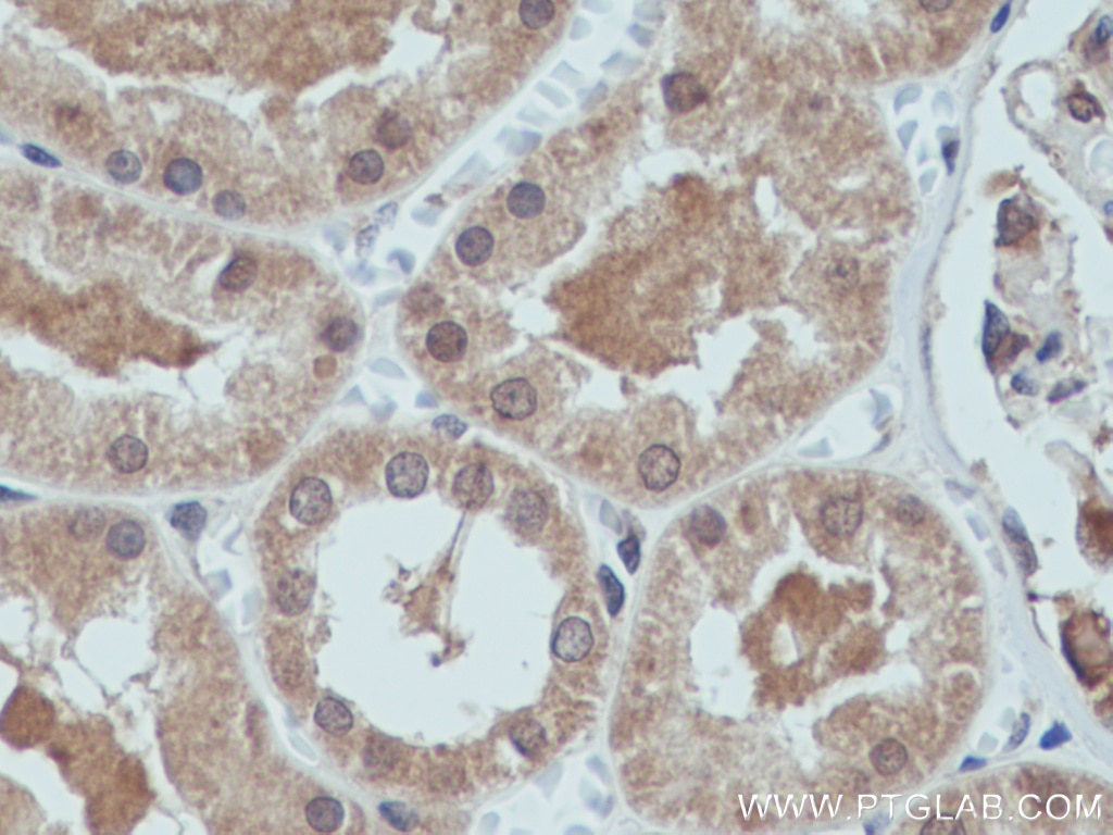 Immunohistochemistry (IHC) staining of human kidney tissue using GLI2-Specific Polyclonal antibody (18989-1-AP)