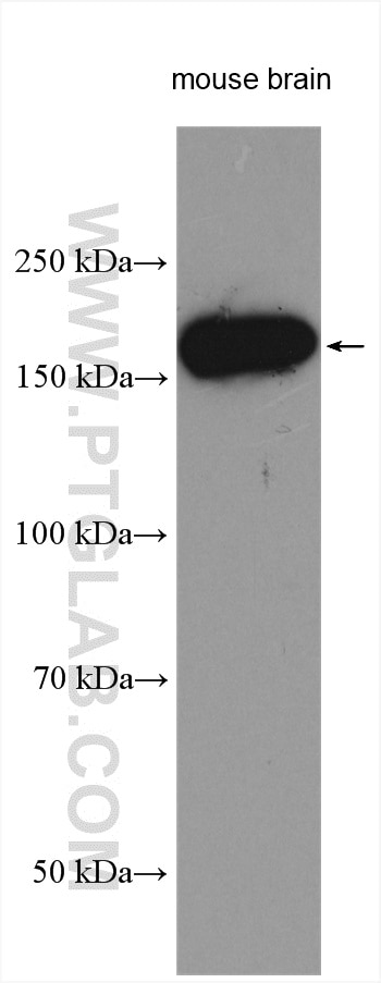 Western Blot (WB) analysis of various lysates using GLI2-Specific Polyclonal antibody (18989-1-AP)