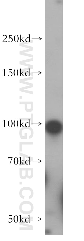 Western Blot (WB) analysis of HEK-293 cells using GLI2-Specific Polyclonal antibody (18989-1-AP)