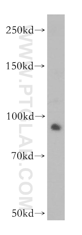 Western Blot (WB) analysis of human testis tissue using GLI2-Specific Polyclonal antibody (18989-1-AP)