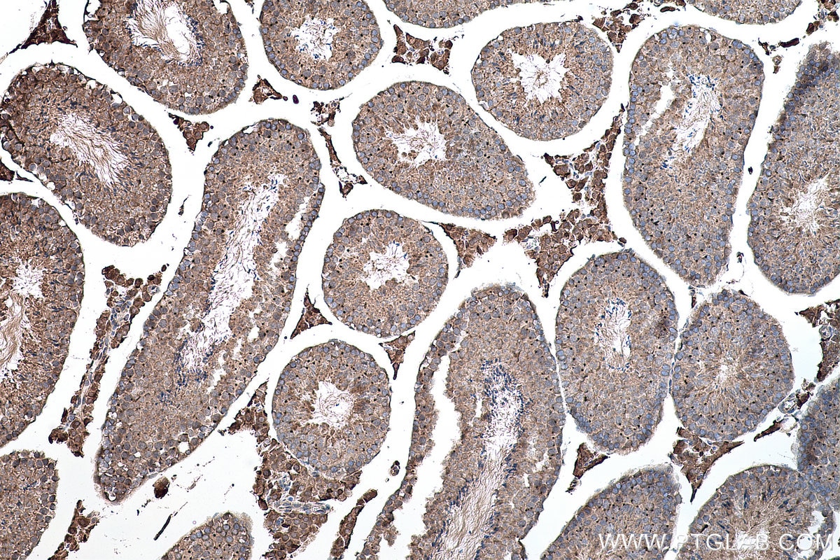Immunohistochemistry (IHC) staining of mouse testis tissue using GLI3 Polyclonal antibody (28272-1-AP)