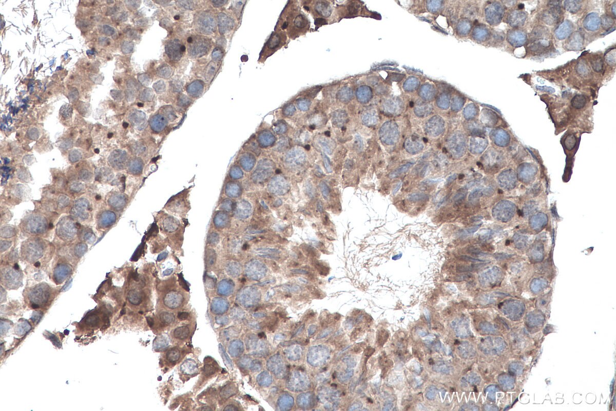 Immunohistochemistry (IHC) staining of mouse testis tissue using GLI3 Polyclonal antibody (28272-1-AP)