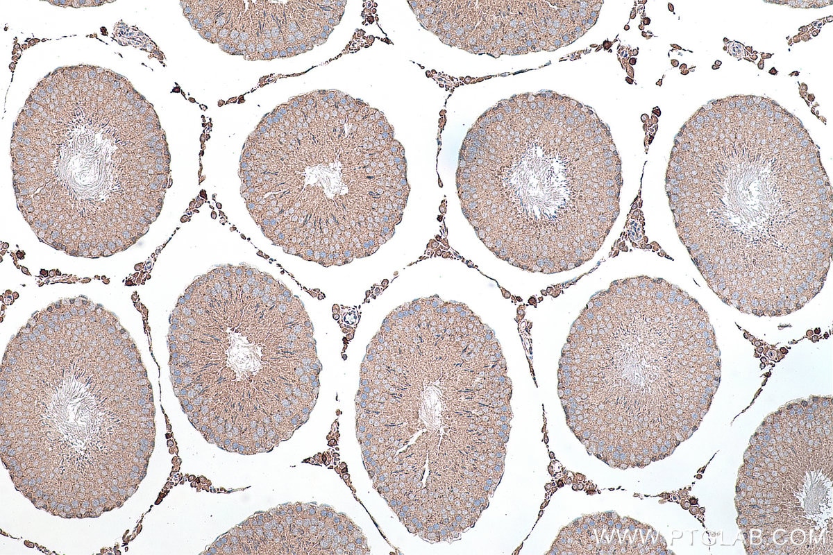 Immunohistochemistry (IHC) staining of rat testis tissue using GLI3 Polyclonal antibody (28272-1-AP)