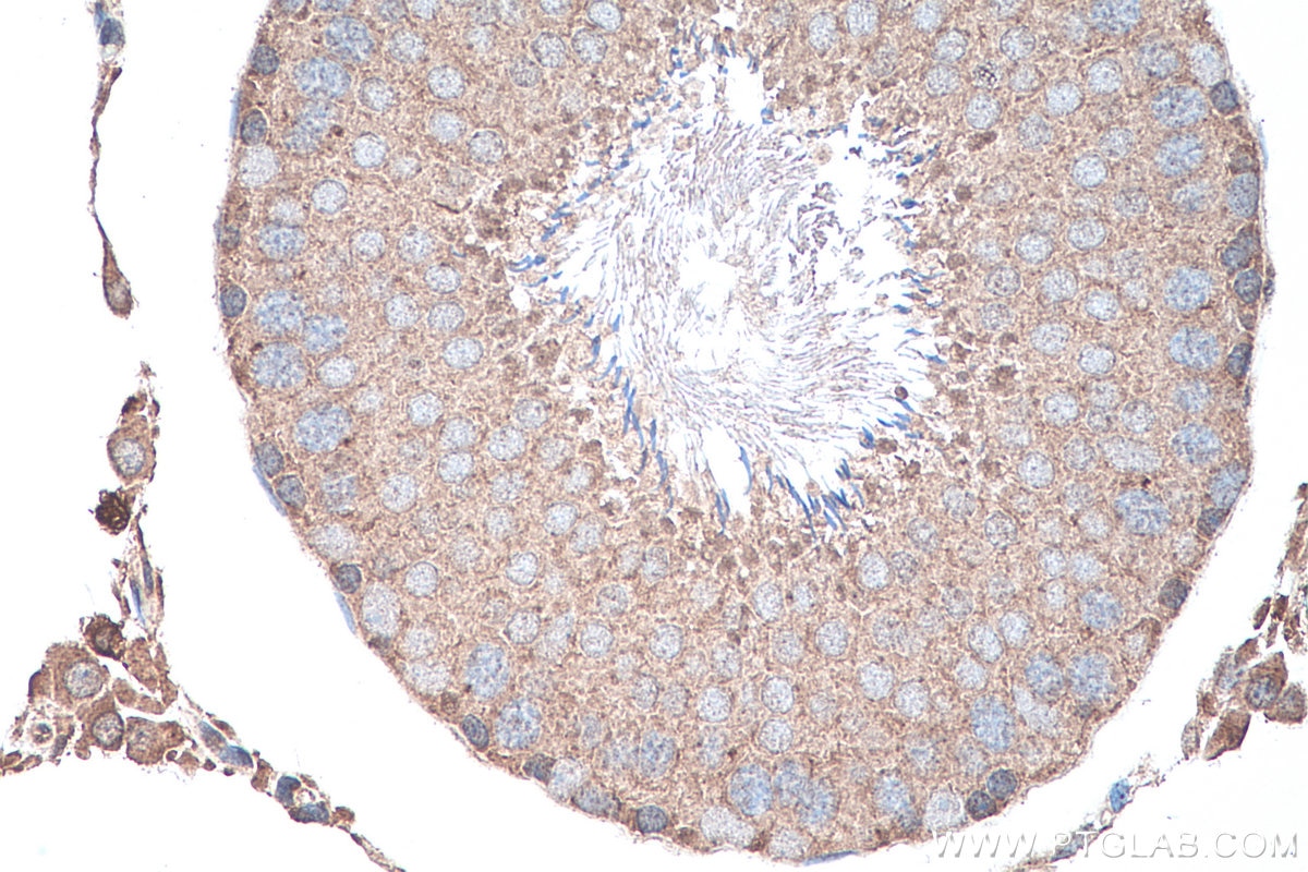 Immunohistochemistry (IHC) staining of rat testis tissue using GLI3 Polyclonal antibody (28272-1-AP)