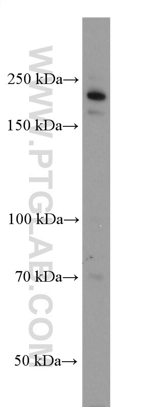 Western Blot (WB) analysis of HepG2 cells using GLI3 Polyclonal antibody (28272-1-AP)