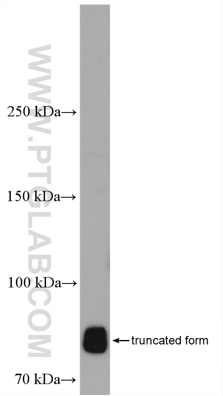 Western Blot (WB) analysis of SKOV-3 cells using GLI3 Polyclonal antibody (28272-1-AP)