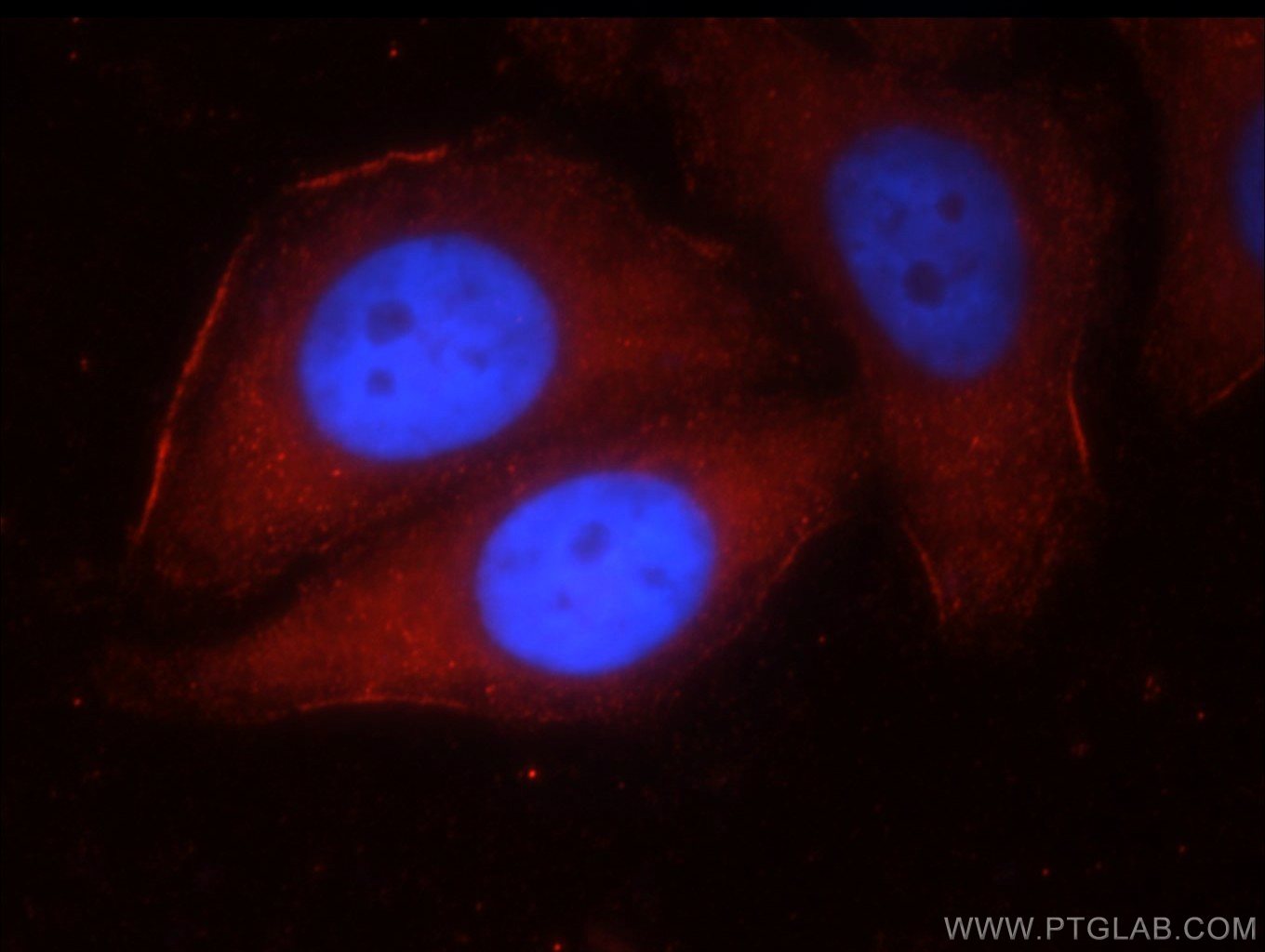 Immunofluorescence (IF) / fluorescent staining of HepG2 cells using GLI3-Specific Polyclonal antibody (19949-1-AP)