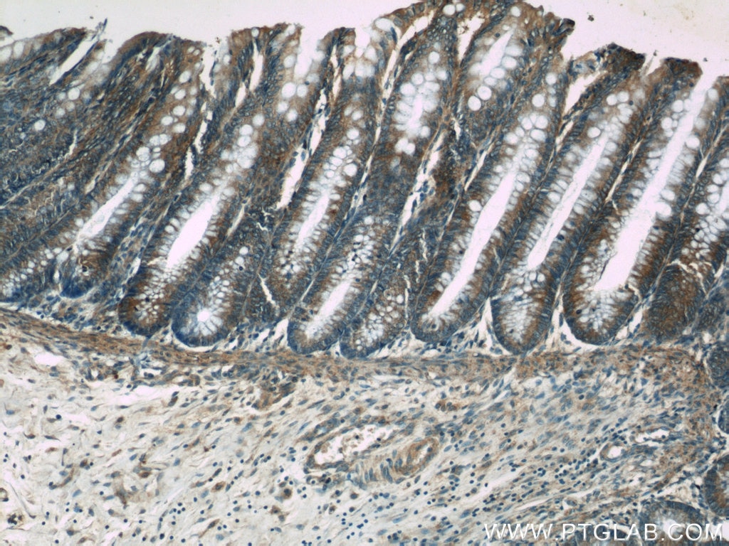 IHC staining of human colon using 19949-1-AP