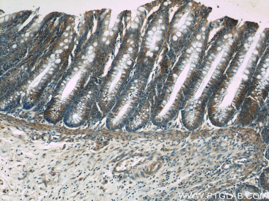 Immunohistochemistry (IHC) staining of human colon tissue using GLI3-Specific Polyclonal antibody (19949-1-AP)