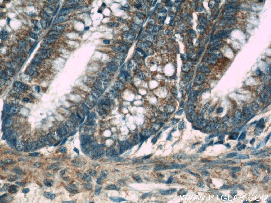 Immunohistochemistry (IHC) staining of human colon tissue using GLI3-Specific Polyclonal antibody (19949-1-AP)