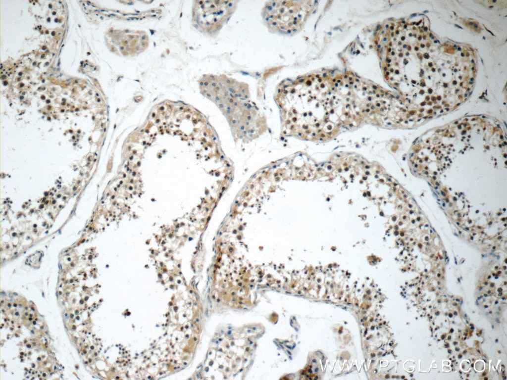 Immunohistochemistry (IHC) staining of human testis tissue using GLI3-Specific Polyclonal antibody (19949-1-AP)