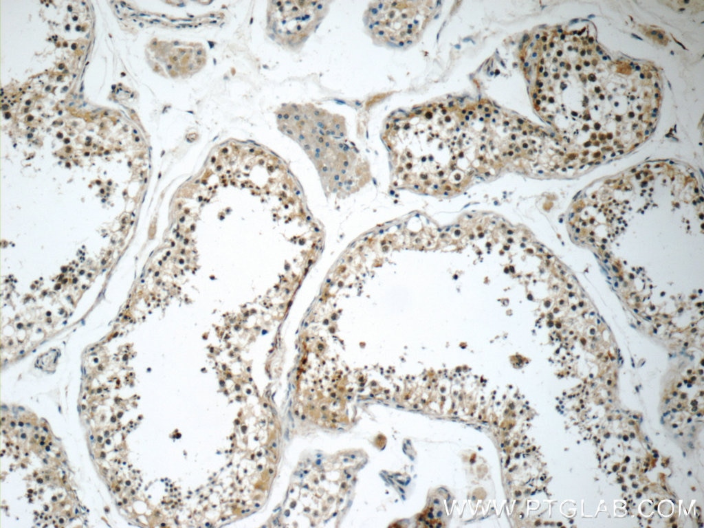 IHC staining of human testis using 19949-1-AP