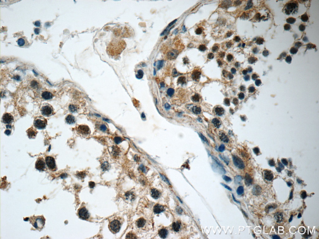 IHC staining of human testis using 19949-1-AP