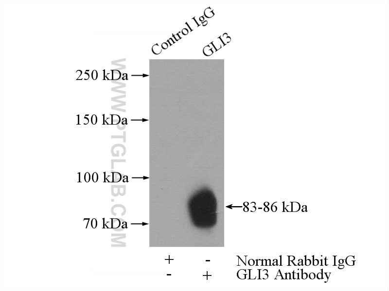 Immunoprecipitation (IP) experiment of mouse lung tissue using GLI3-Specific Polyclonal antibody (19949-1-AP)