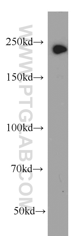 Western Blot (WB) analysis of human placenta tissue using GLI3-Specific Polyclonal antibody (19949-1-AP)