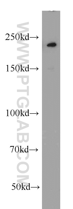 Western Blot (WB) analysis of human placenta tissue using GLI3-Specific Polyclonal antibody (19949-1-AP)