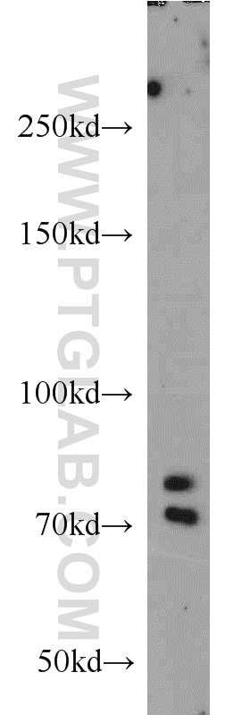 Western Blot (WB) analysis of mouse lung tissue using GLI3-Specific Polyclonal antibody (19949-1-AP)