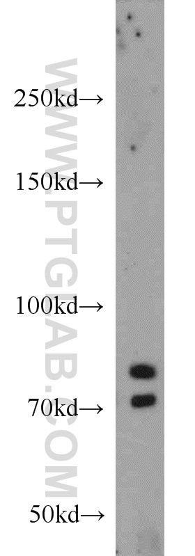Western Blot (WB) analysis of mouse lung tissue using GLI3-Specific Polyclonal antibody (19949-1-AP)
