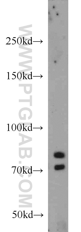 WB analysis of mouse lung using 19949-1-AP