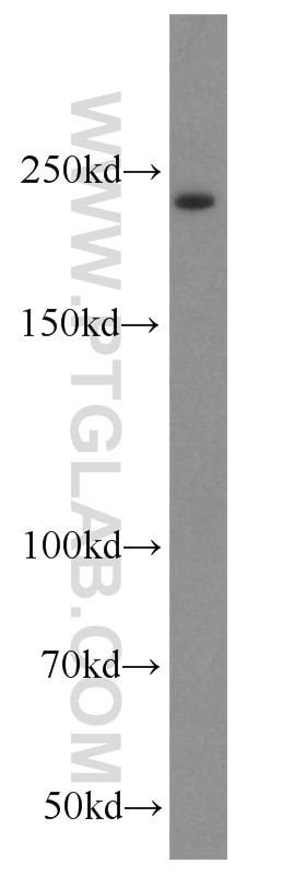 Western Blot (WB) analysis of human placenta tissue using GLI3-Specific Polyclonal antibody (19949-1-AP)