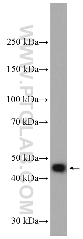 Western Blot (WB) analysis of Jurkat cells using GLI4 Polyclonal antibody (16551-1-AP)