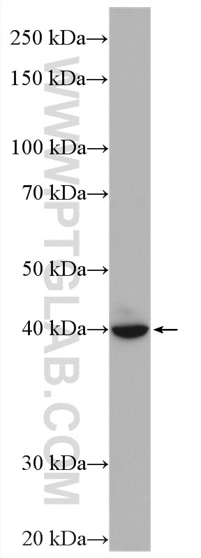 Western Blot (WB) analysis of SH-SY5Y cells using GLI4 Polyclonal antibody (16551-1-AP)