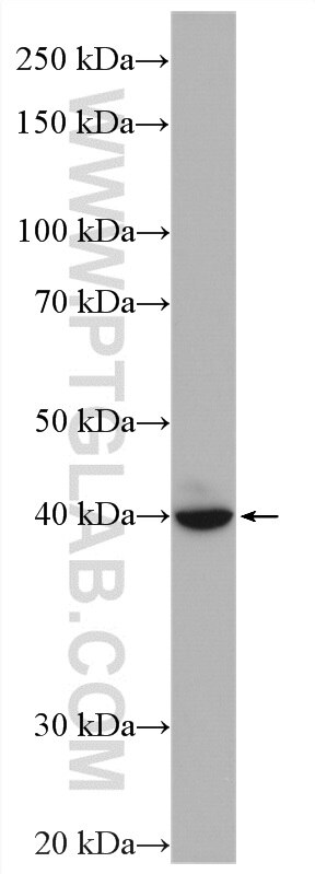 WB analysis of SH-SY5Y using 16551-1-AP