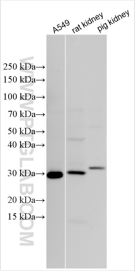 Western Blot (WB) analysis of various lysates using GLIPR1 Polyclonal antibody (12517-1-AP)
