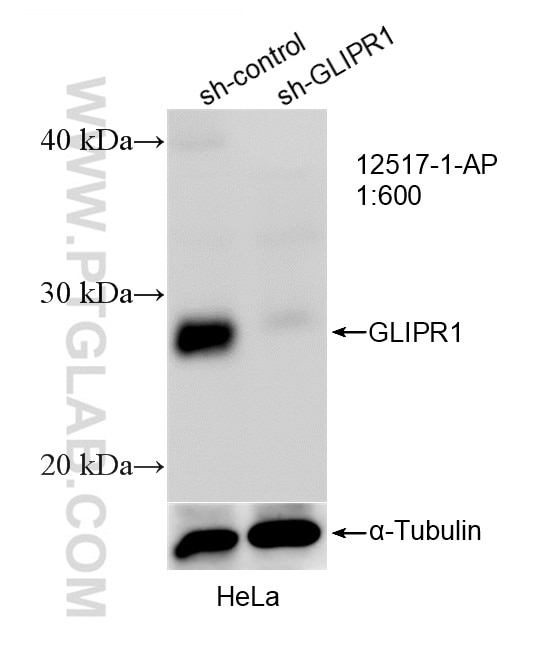 Western Blot (WB) analysis of HeLa cells using GLIPR1 Polyclonal antibody (12517-1-AP)