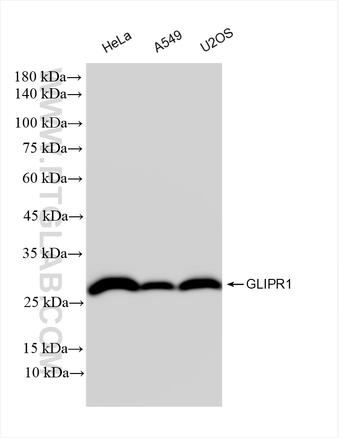 Western Blot (WB) analysis of various lysates using GLIPR1 Recombinant antibody (85345-1-RR)