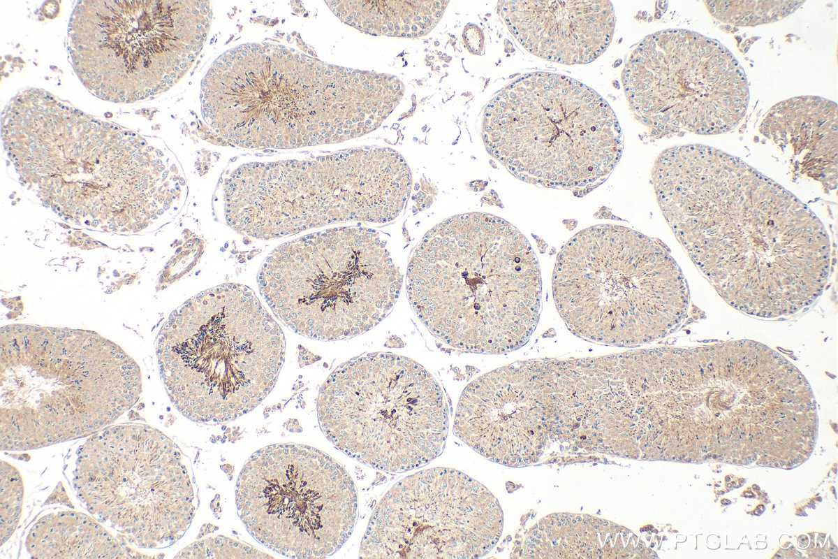 Immunohistochemistry (IHC) staining of mouse testis tissue using GLIPR1L1 Polyclonal antibody (20828-1-AP)
