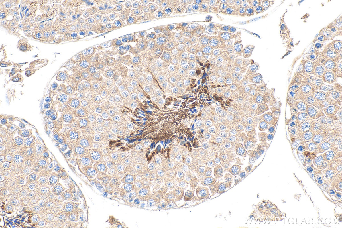Immunohistochemistry (IHC) staining of mouse testis tissue using GLIPR1L1 Polyclonal antibody (20828-1-AP)