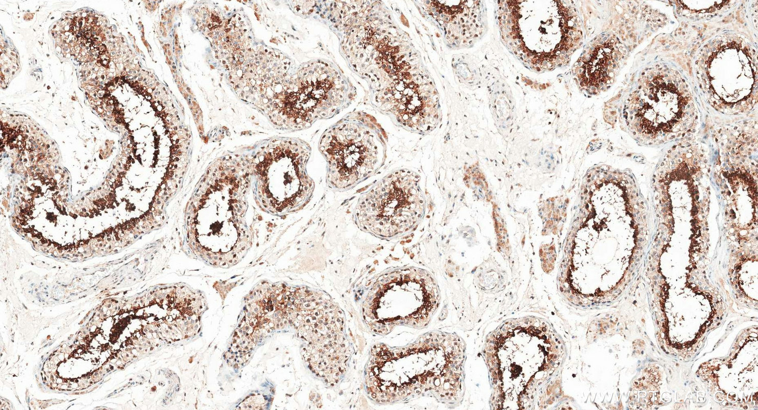 IHC staining of human testis using 20828-1-AP Immunohistochemistry (IHC) staining of human testis tissue using GLIPR1L1 Polyclonal antibody (20828-1-AP)