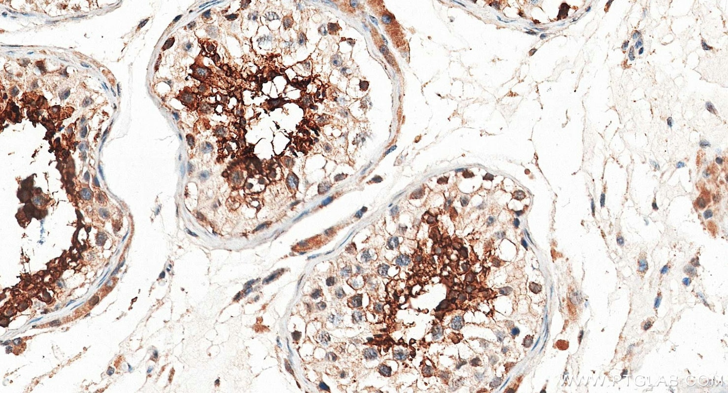 IHC staining of human testis using 20828-1-AP Immunohistochemistry (IHC) staining of human testis tissue using GLIPR1L1 Polyclonal antibody (20828-1-AP)