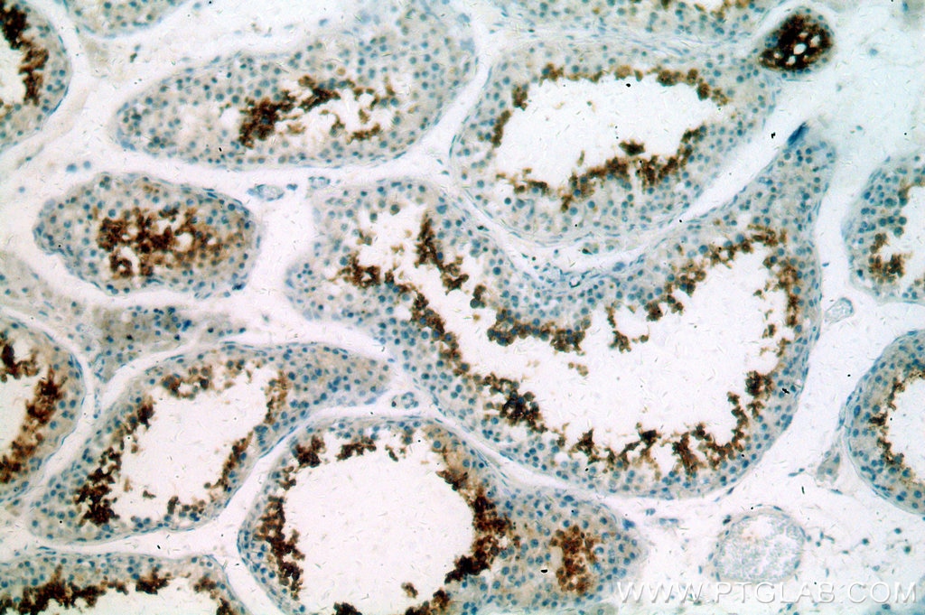 Immunohistochemistry (IHC) staining of human testis tissue using GLIPR1L1 Polyclonal antibody (20828-1-AP)