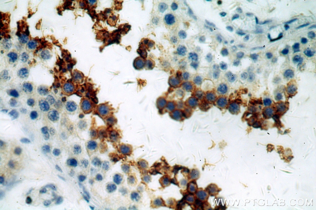 Immunohistochemistry (IHC) staining of human testis tissue using GLIPR1L1 Polyclonal antibody (20828-1-AP)