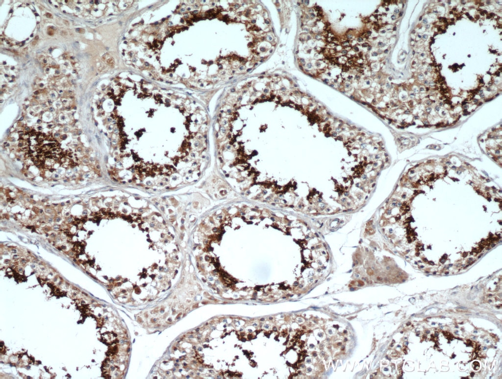 Immunohistochemistry (IHC) staining of human testis tissue using GLIPR1L1 Polyclonal antibody (20828-1-AP)