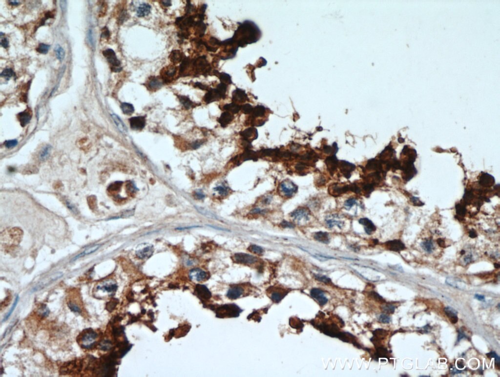 Immunohistochemistry (IHC) staining of human testis tissue using GLIPR1L1 Polyclonal antibody (20828-1-AP)