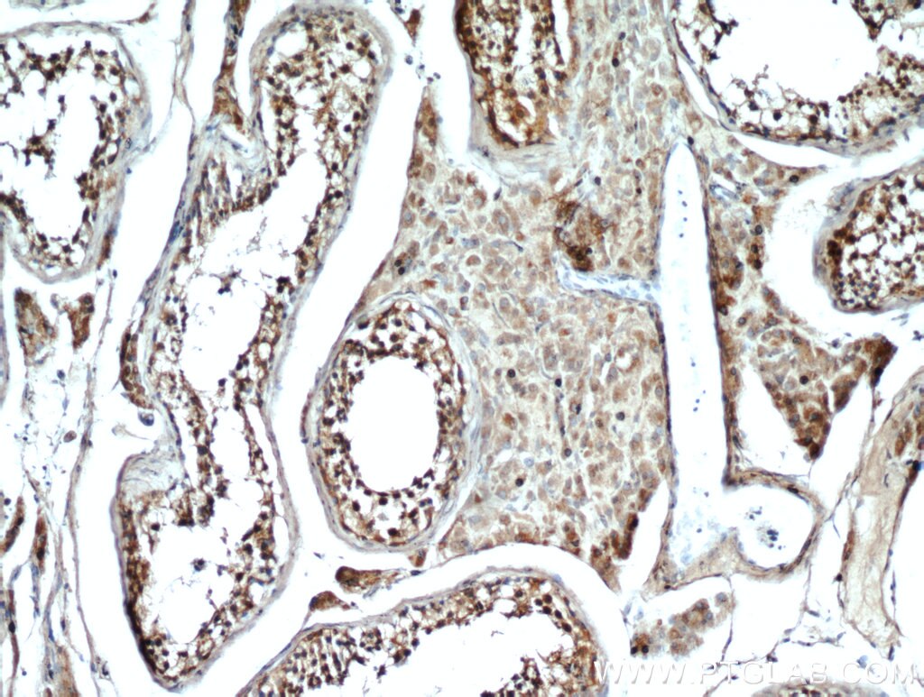 Immunohistochemistry (IHC) staining of human testis tissue using GLIPR1L1 Polyclonal antibody (20828-1-AP)