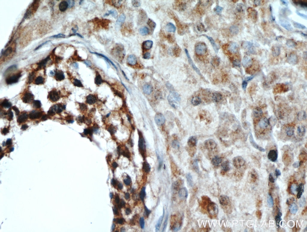 IHC staining of human testis using 20828-1-AP