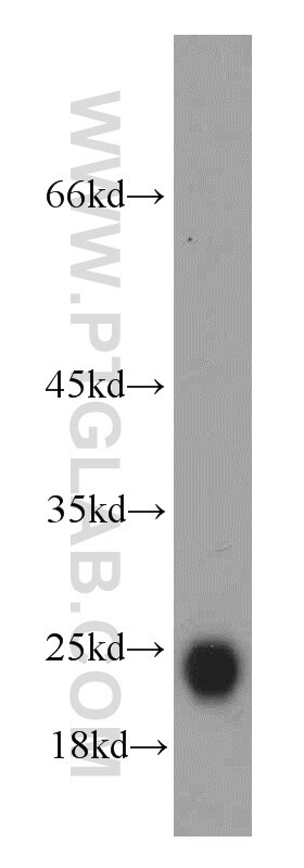 Western Blot (WB) analysis of human testis tissue using GLIPR1L1 Polyclonal antibody (20828-1-AP)