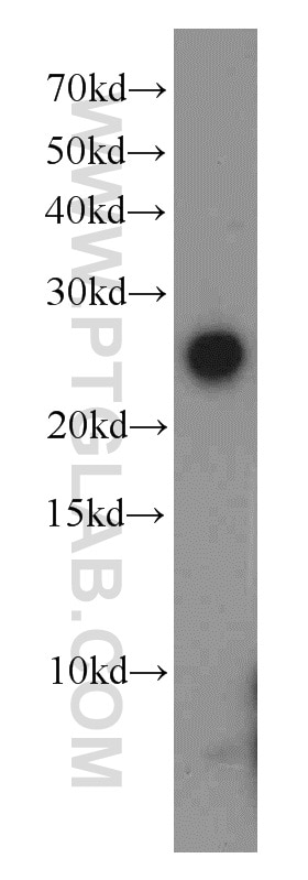 Western Blot (WB) analysis of human testis tissue using GLIPR1L1 Polyclonal antibody (20828-1-AP)