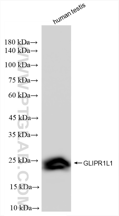 Western Blot (WB) analysis of human testis tissue using GLIPR1L1 Recombinant antibody (83584-3-RR)
