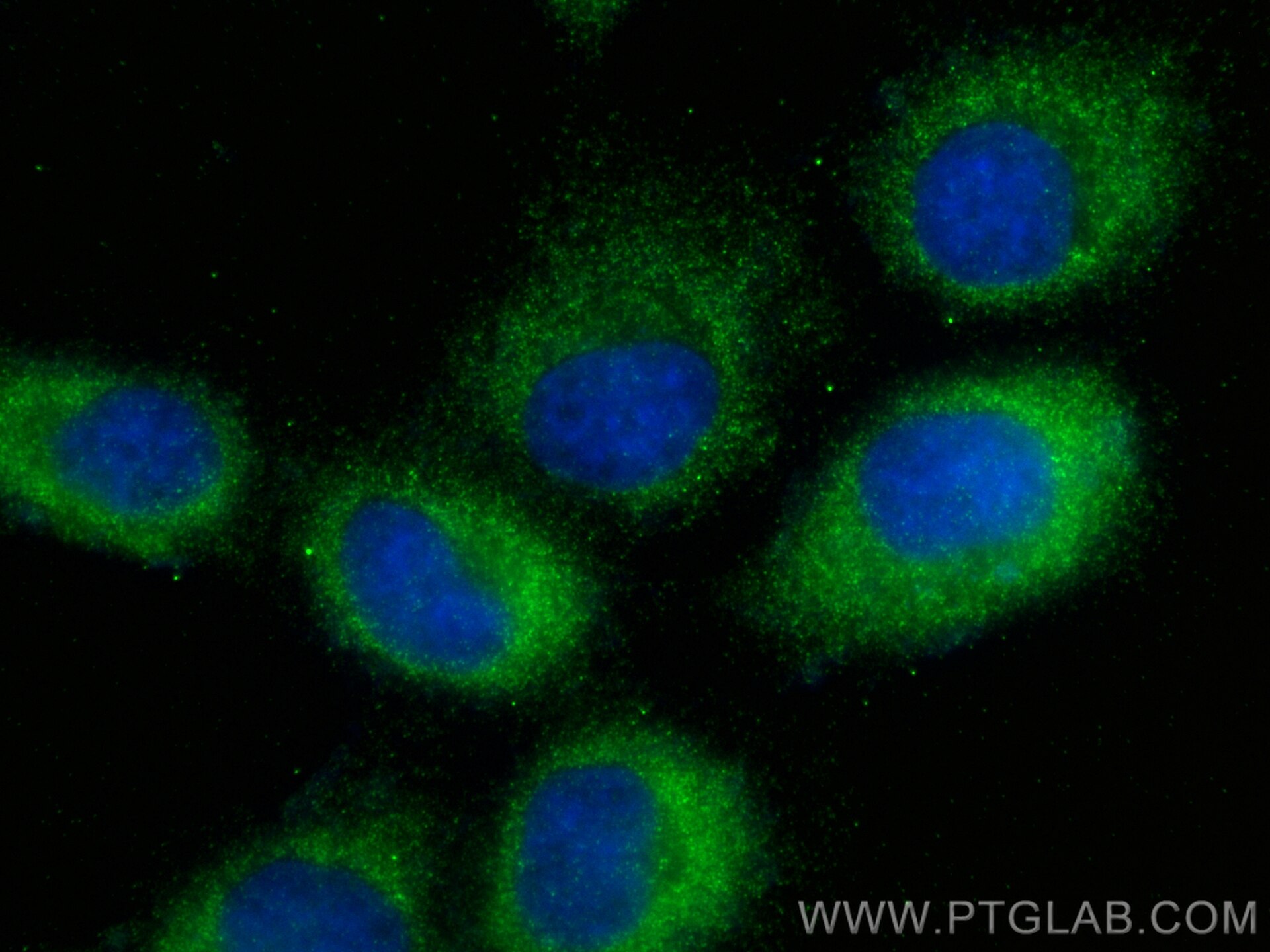 Immunofluorescence (IF) / fluorescent staining of A431 cells using GLIPR2 Polyclonal antibody (16508-1-AP)