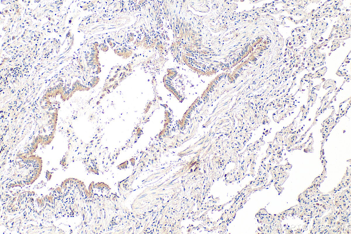 Immunohistochemistry (IHC) staining of human lung tissue using GLIPR2 Polyclonal antibody (16508-1-AP)