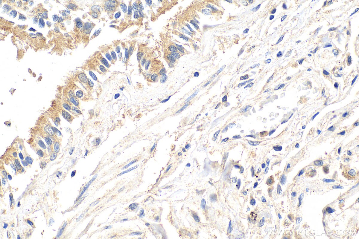 Immunohistochemistry (IHC) staining of human lung tissue using GLIPR2 Polyclonal antibody (16508-1-AP)