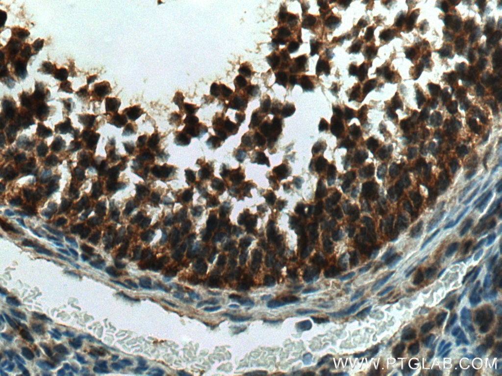 Immunohistochemistry (IHC) staining of mouse ovary tissue using GLIS1 Polyclonal antibody (23138-1-AP)